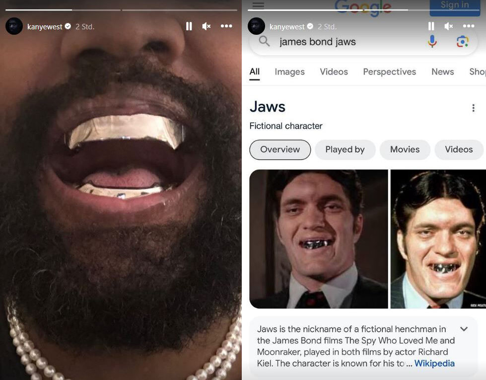 Kanye West Titan-Zahnprothesen